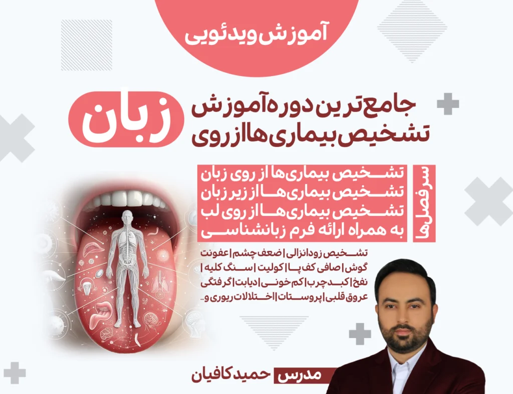 دوره جامع تشخیص بیماری ها از روی زبان